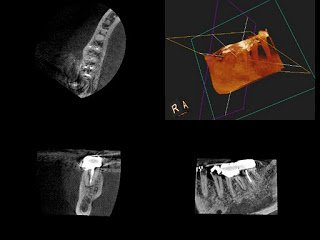 The Dental Operating Microscope Prevents