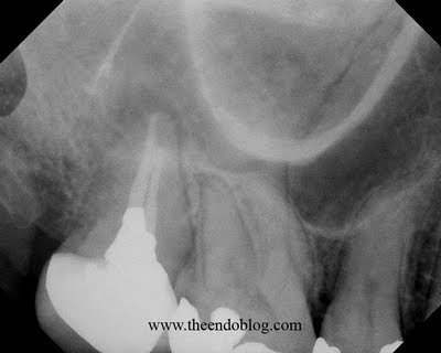 To Scan or Not to Scan?