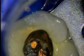 Challenging Isolation