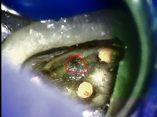 This, Not That, Follow up