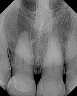 Who Cares About the Periodontal Ligament?