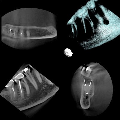 Superstition Springs Endodontics goes 3D